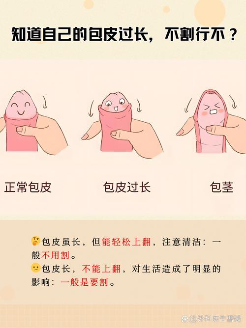 惊!包皮过长怎么判断?这5个信号你居然不知道?