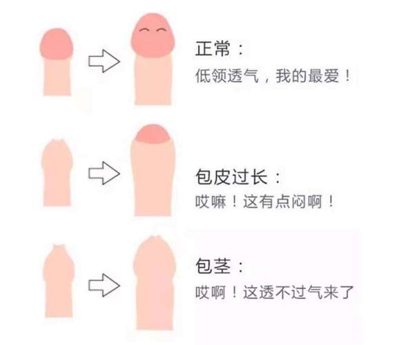 包皮过长和包茎的区别，你竟然还不知道？小心健康亮红灯！
