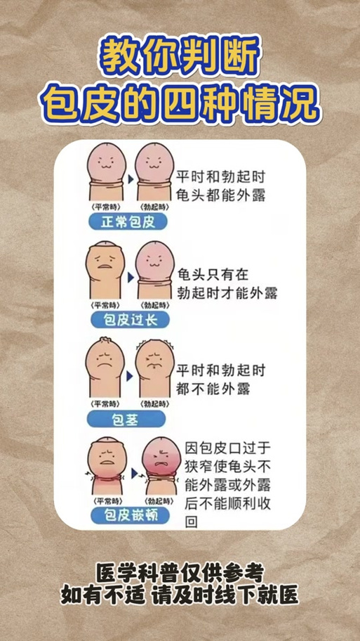 包皮过长和包茎的区别，你竟然还不知道？小心健康亮红灯！