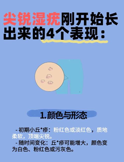 尖锐湿疣的初期症状,这些不起眼的小信号你竟然忽略了?现在知道还不晚!