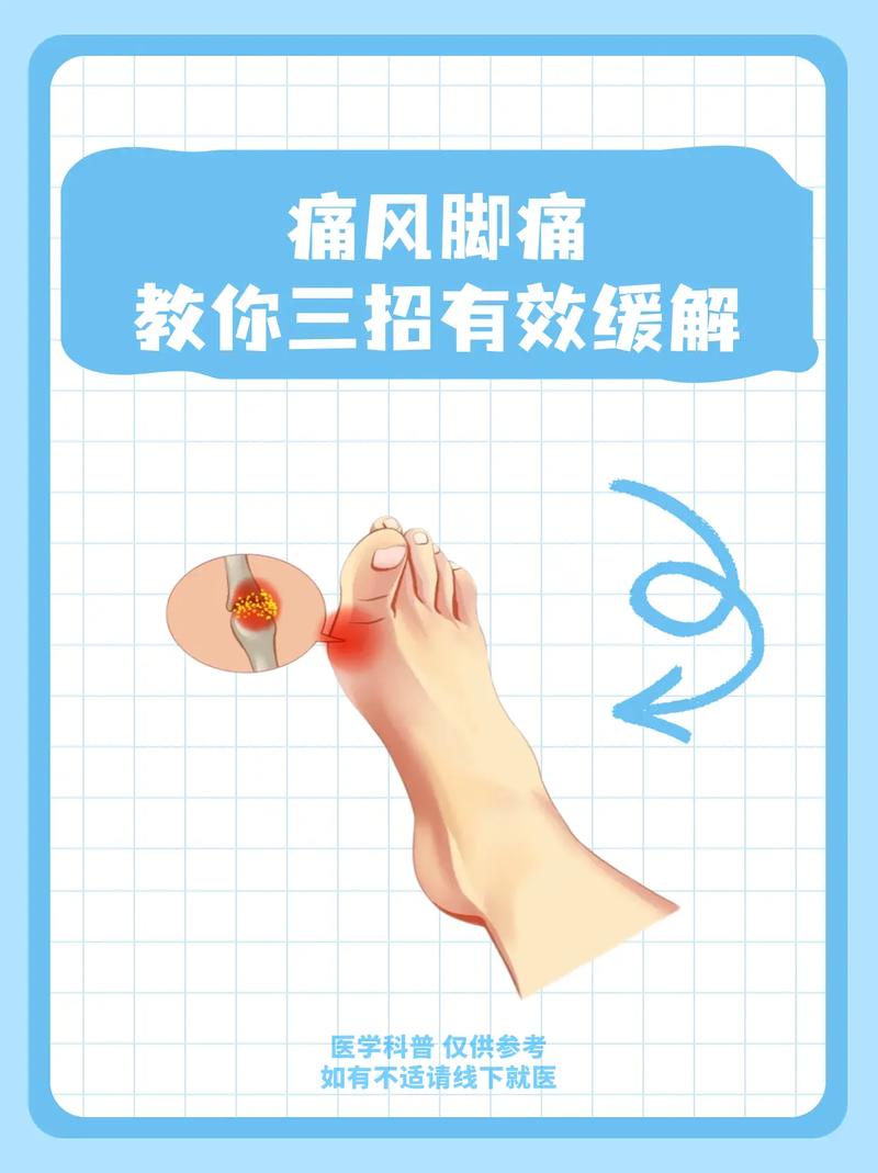 痛风脚肿怎么消肿止痛?3个小妙招快速缓解,走路不再疼!