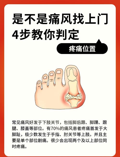 痛风脚肿怎么消肿止痛?3个小妙招快速缓解,走路不再疼!