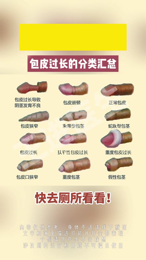包皮过长是什么样子？一分钟自检，别让“小麻烦”拖成大问题！