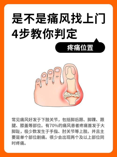 痛风悄悄找上门？怎么判断自己痛风了，这些信号别忽视！