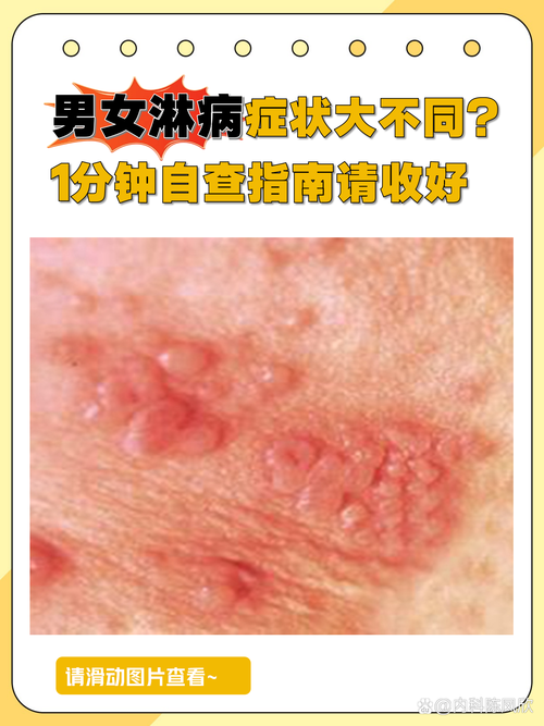 上海性病医院：别让“一时冲动”毁了你！这些症状速查指南能救命