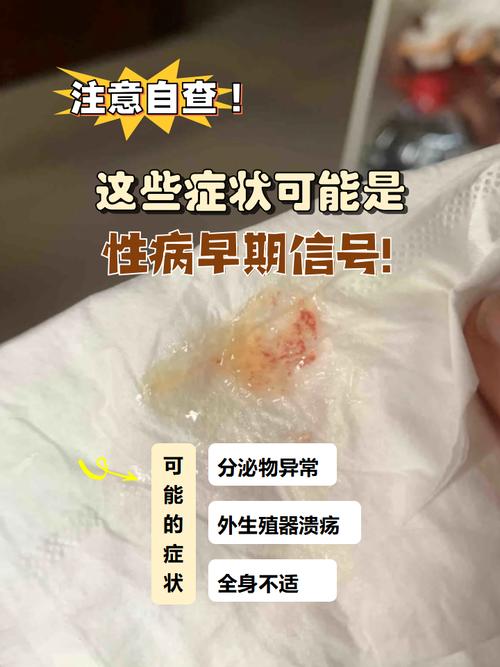 警惕！性病的早期症状有这些，别等严重了才后悔！