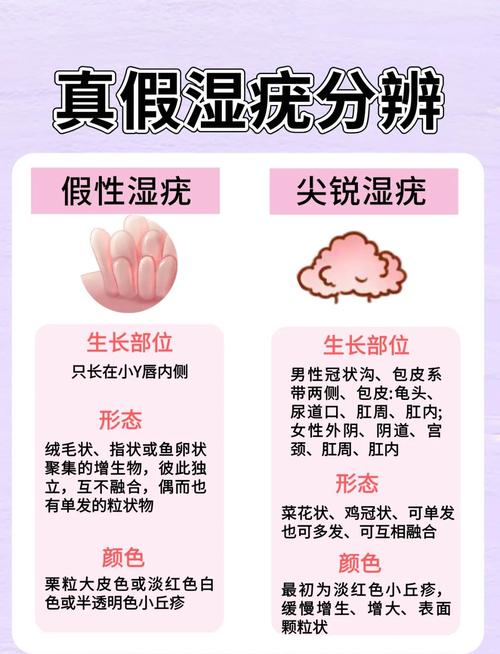 尖锐湿疣是性病么？别慌，3分钟带你认清真相！