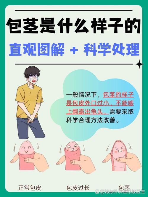 包茎包皮过长别忽视！这些健康隐患现在知道还不晚