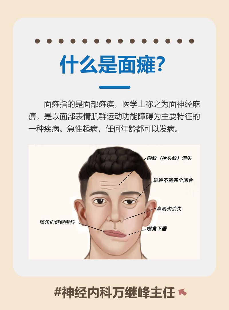 面瘫是什么原因引起的？这7个“元凶”你可能天天在接触！