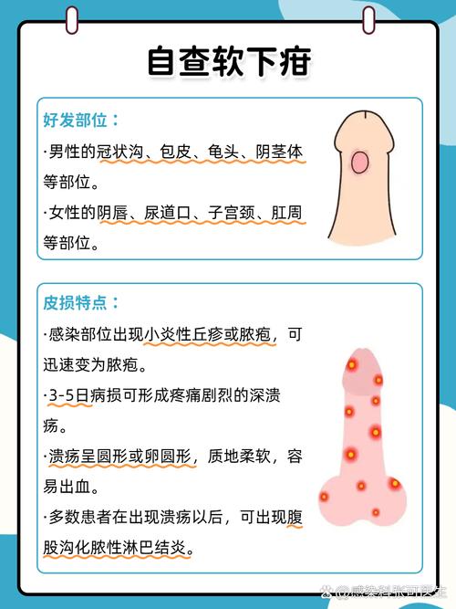 男性性病图片警示:这些症状别忽视,立即对照自查!