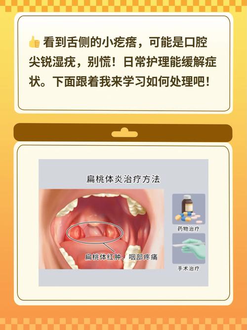 口腔尖锐湿疣怎么治疗?别慌!这份轻松有趣的治愈指南请收好
