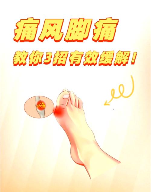 痛风消肿止痛最快方法！3招轻松缓解，让你立刻告别疼痛折磨