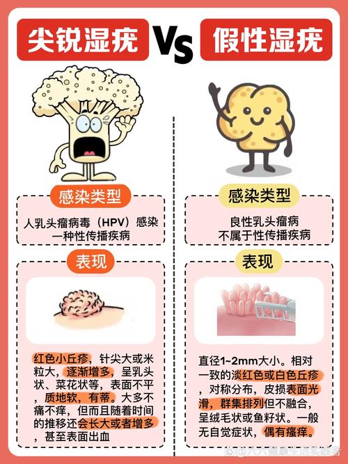 尖锐湿疣多久能治愈?别焦虑,这份时间表让你心里有底!