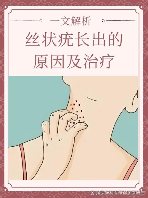 丝状疣是什么原因长出来的？别小看这些小肉揪，可能是身体在拉警报！