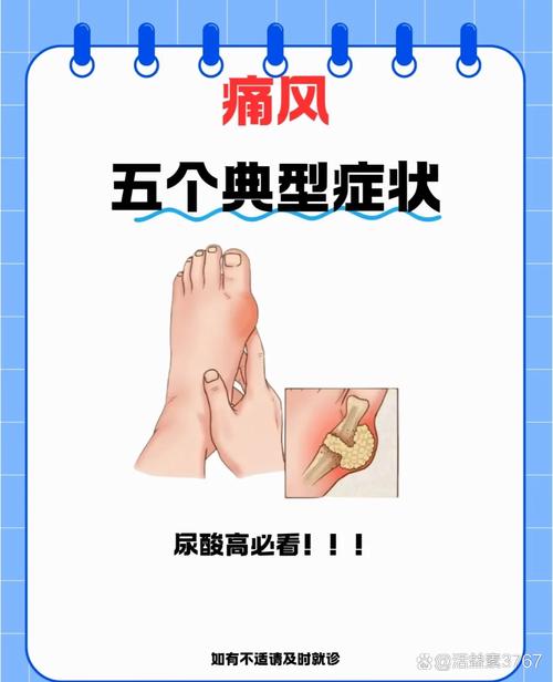 痛风症状的早期表现，这5个信号别忽视，现在知道还来得及！