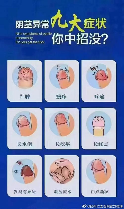男性下面感染早期症状有哪些？别大意，这5个信号要警惕！