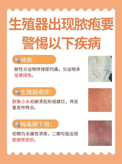 男性下面感染早期症状有哪些?别大意,这5个信号要警惕!