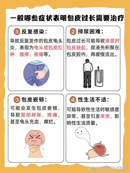 包皮过长导致早泄？别让这个“小麻烦”影响你的性福生活！