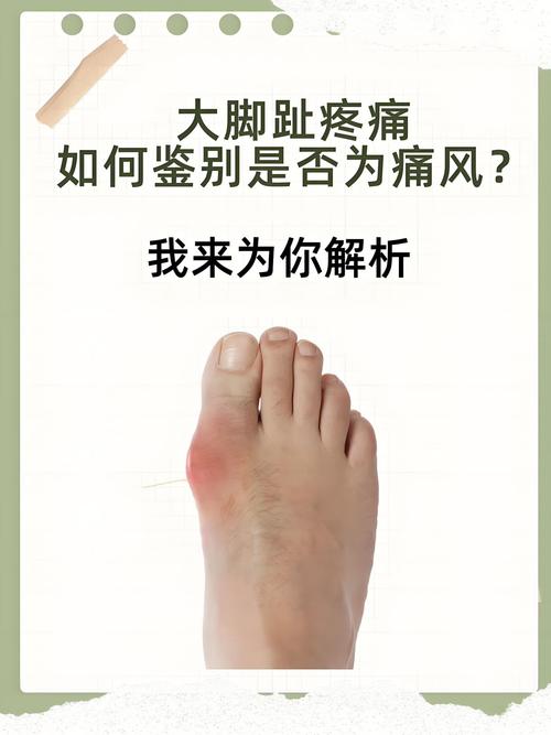 女人痛风先痛在哪里?别等脚趾剧痛才后悔!