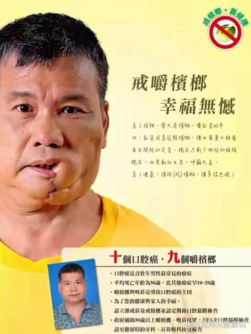 【槟榔的危害】别让“嚼”出来的快乐,变成“咬”住的痛苦!