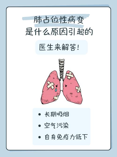 肺占位性病变是什么？别慌！这几种情况其实很常见