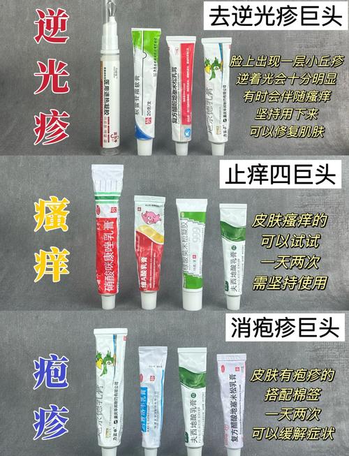 过敏性皮炎吃什么药？医生紧急提醒：这几种药膏千万别乱涂！