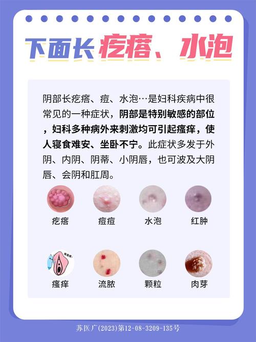 糟了！下面长了小疙瘩？女生必看的尖锐湿疣自救指南，别让尴尬耽误你！