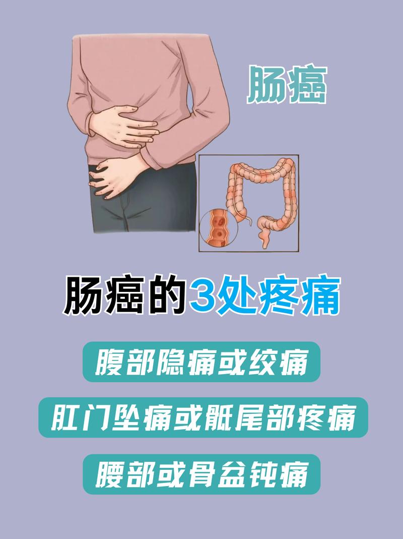 肠癌会拉肚子吗?出现这几种情况要当心,别让身体发出警报!