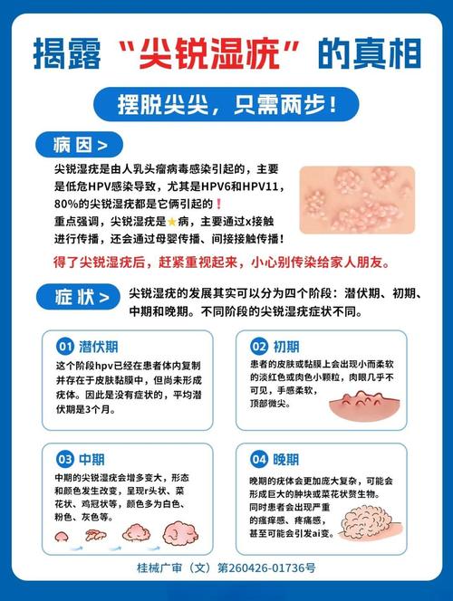 尖锐湿疣好治疗吗？别怕！专家教你轻松搞定，告别尴尬困扰