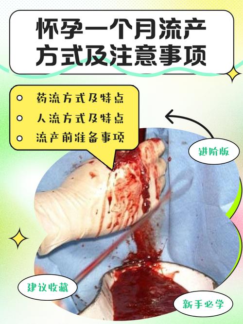 怀孕一个月做人流,这些关键事项你必须知道!