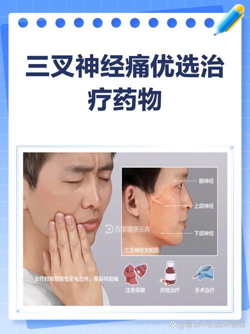 三叉神经痛吃什么药？这份“救命指南”让你立刻告别剧痛！