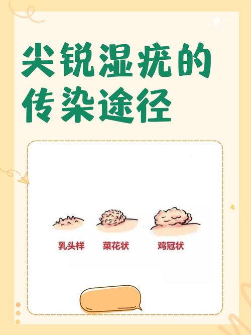 尖锐湿疣会不会传染？别慌！一文说清传染途径与预防关键