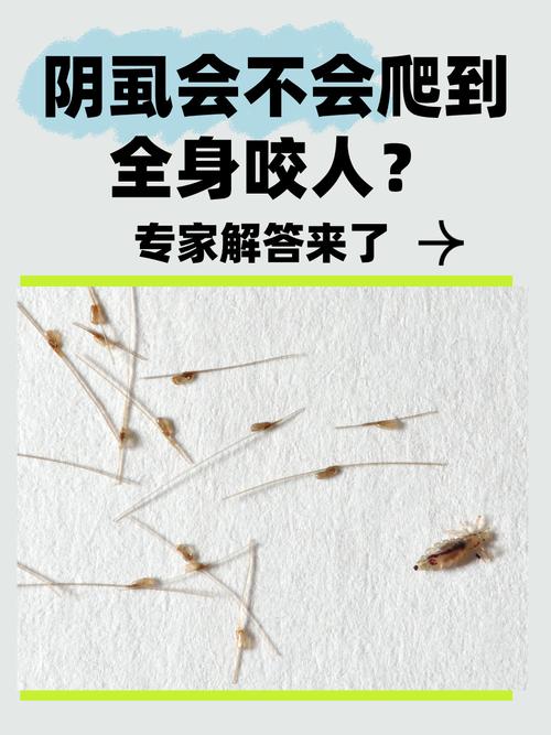 阴虱是什么原因得的？这些日常小习惯可能正把你推向感染边缘！