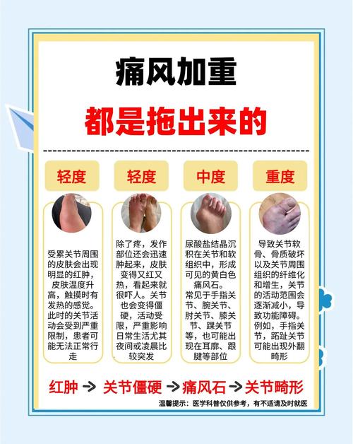如何判断是不是痛风?这5个信号一出现就要当心了!