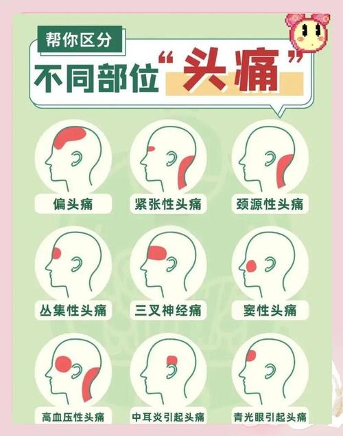 偏头疼是什么原因引起？揪出这些“隐形元凶”，头不再痛！