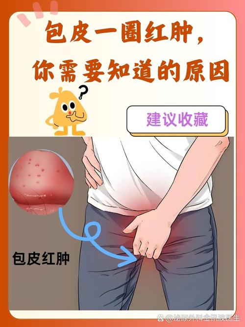 包皮过长的症状有哪些？别忽视这几点，小心拖出大问题！