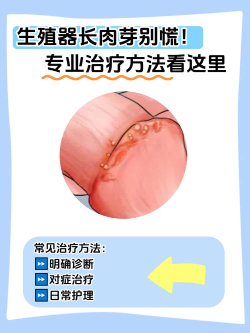 性病怎么治疗?别慌!专家教你轻松应对的正确方法