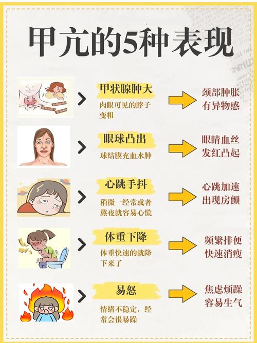 甲亢是慢性病吗？别慌！专家教你轻松应对，告别长期困扰