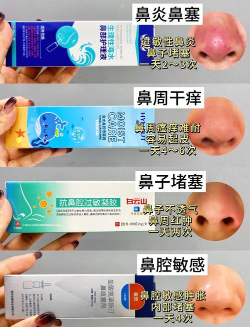 鼻炎吃什么药?专家教你轻松选对药,告别鼻塞烦恼!