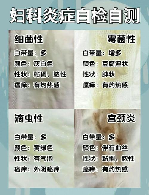 霉菌感染是什么原因引起的?这5个日常习惯你可能正在做!