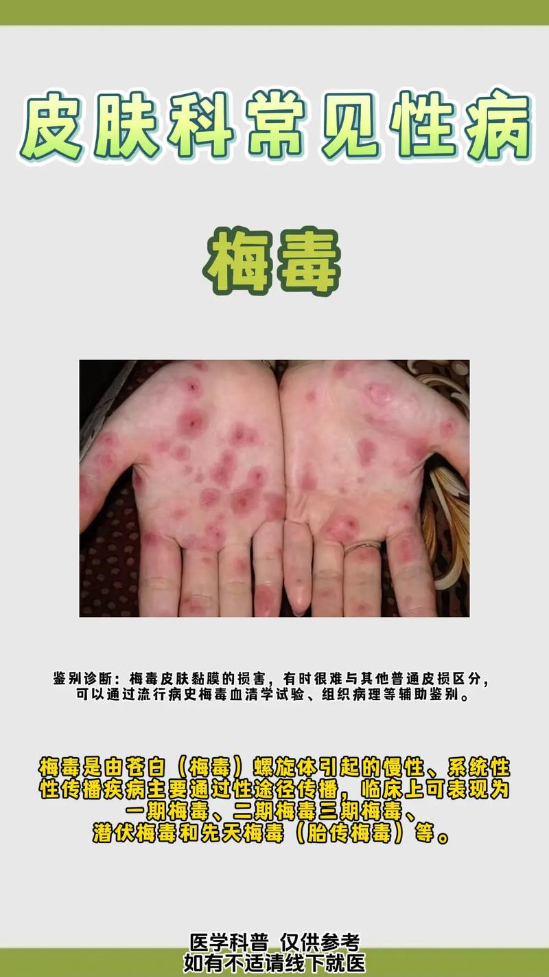 警惕!性病的种类竟然这么多,你了解几种?