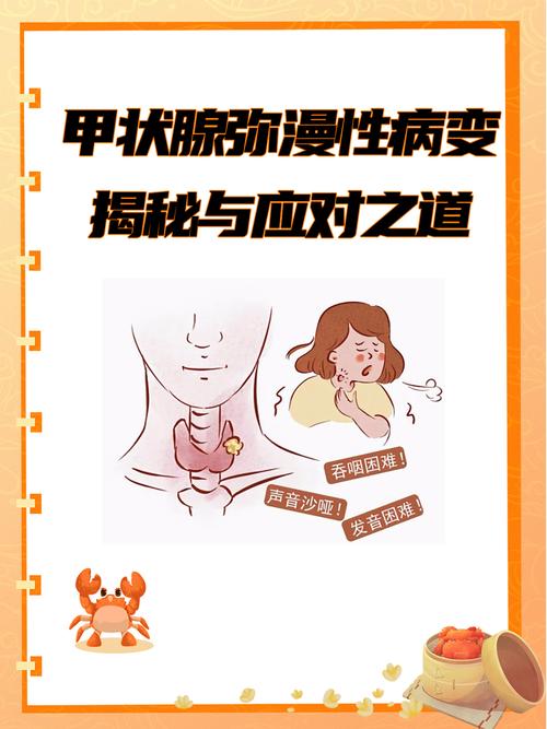 甲状腺弥漫性病变是什么意思？别慌！看懂这篇轻松掌握健康要点