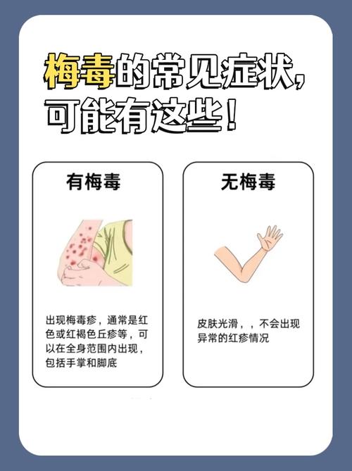 性病初期症状悄悄找上门？这些信号千万别忽视！