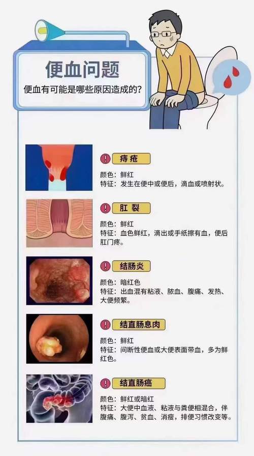 大便出血是怎么回事男性?别慌!这5个原因一定要知道!