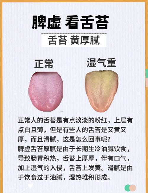 舌苔发黄厚腻是什么原因怎么调理？3招轻松告别“黄厚腻”，肠胃都舒服了！