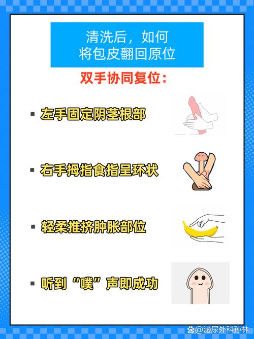 青春期包皮过长别慌张！轻松搞懂正确处理与护理指南