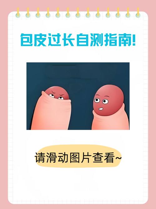 啥是包皮过长?别害羞,3分钟让你彻底搞懂它!