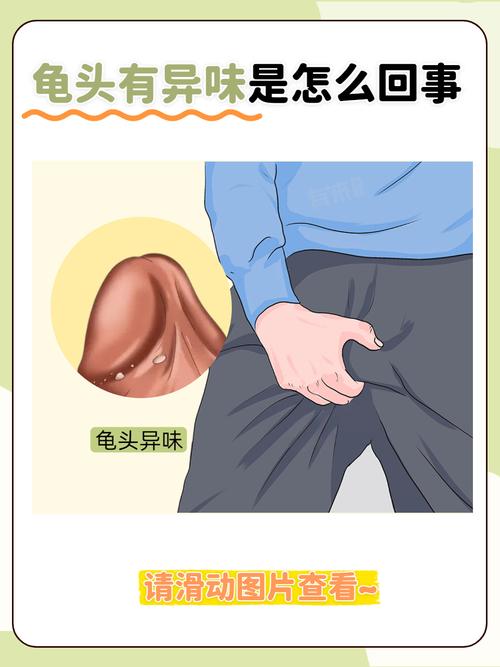 包皮过长有异味怎么办？别慌，这3个轻松小妙招帮你快速解决尴尬！