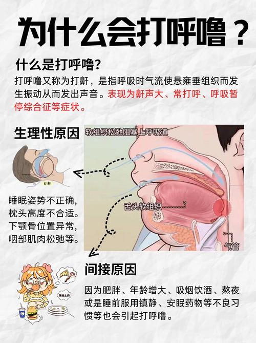 打呼噜是什么原因引起的？别让呼噜声偷走你的健康睡眠！