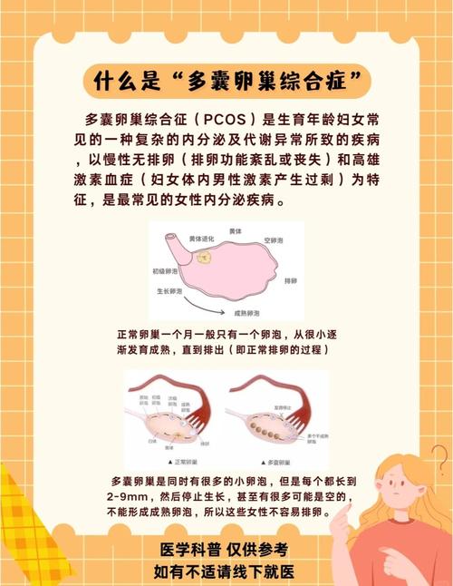 多囊是什么原因引起的？轻松搞懂身体小秘密，告别困扰！